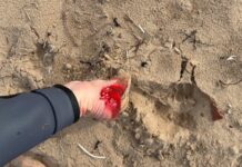 Teen bitten by shark at Middleton